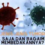 Jenis-Jenis Tumor Apa Saja dan Bagaimana Membedakannya