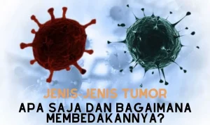 Jenis-Jenis Tumor Apa Saja dan Bagaimana Membedakannya